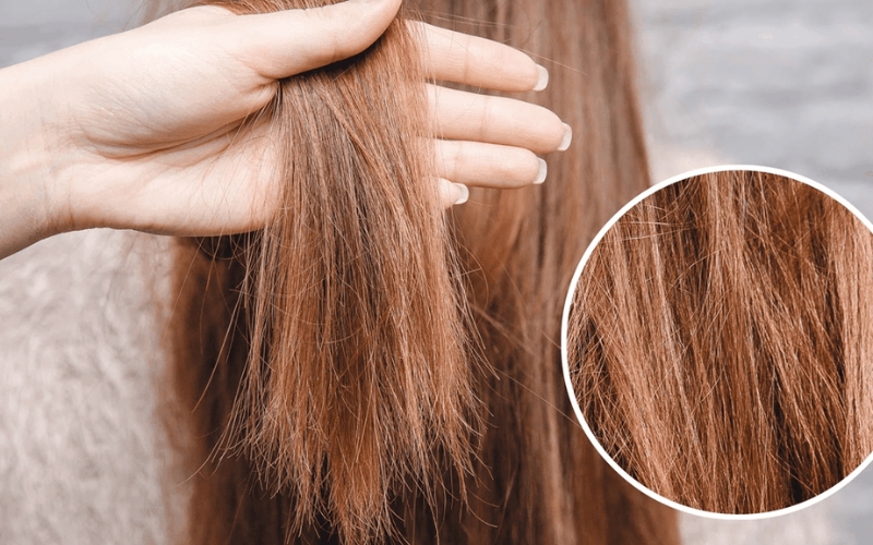 5 dấu hiệu tóc hư tổn nặng và cách phục hồi tại nhà
