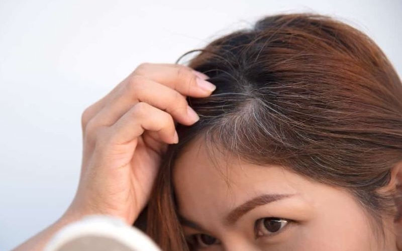 Nguyên nhân tóc bạc sớm ở người trẻ và cách khắc phục từ thảo dược