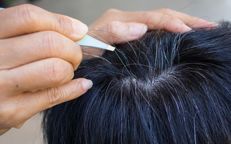 Nguyên nhân tóc bạc sớm ở người trẻ và cách khắc phục từ thảo dược