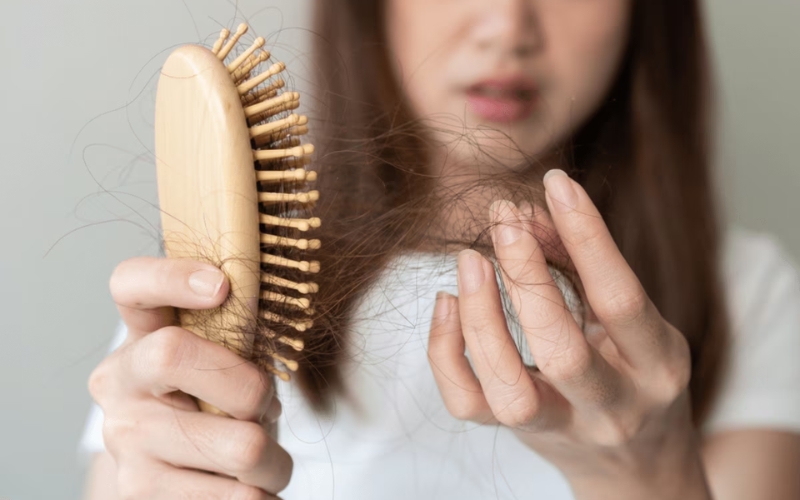 Rụng tóc nhiều: 5 nguyên nhân và cách khắc phục từ gốc rễ