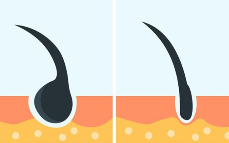 Rụng tóc nhiều: 5 nguyên nhân và cách khắc phục từ gốc rễ