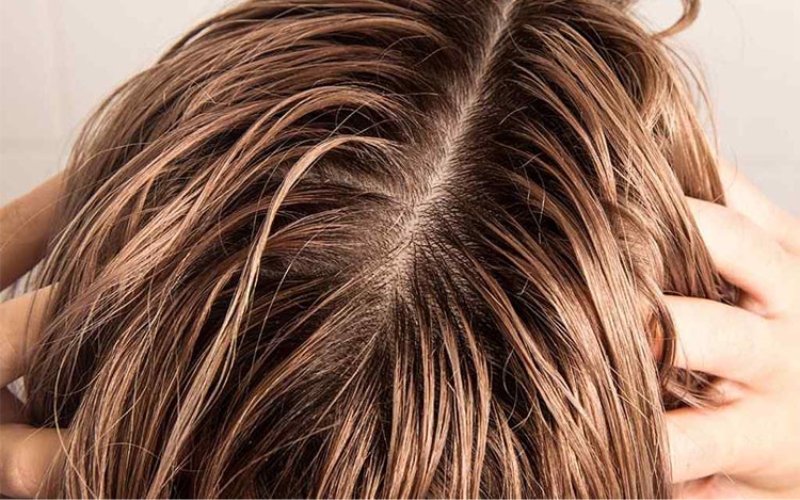Tóc bết dầu: 5 nguyên nhân và cách xử lý hiệu quả tại nhà