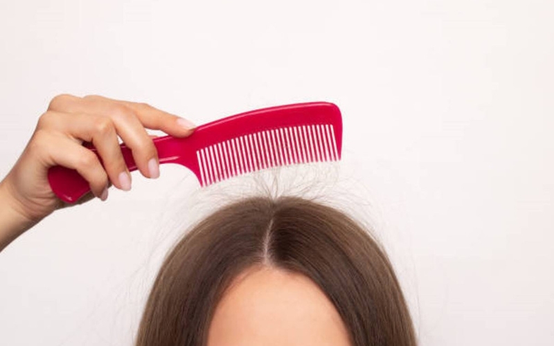 Tóc tĩnh điện vào mùa đông: 5 mẹo khắc phục để tóc hết dựng ngược